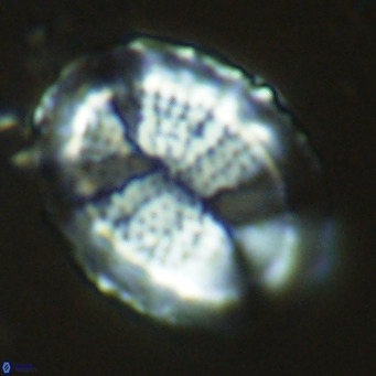 Pontosphaera lepida VR 09052