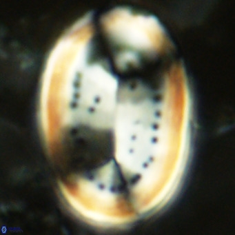 Pontosphaera sparsiforata VR 07527