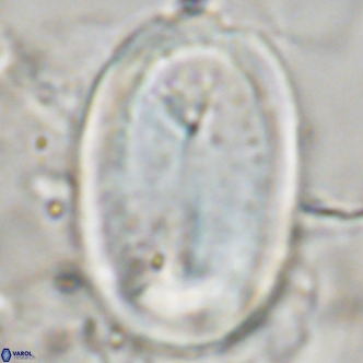 Pontosphaera sparsiforata VR 07534