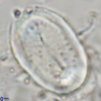 Pontosphaera sparsiforata VR 07536