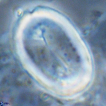 Pontosphaera sparsiforata VR 07537