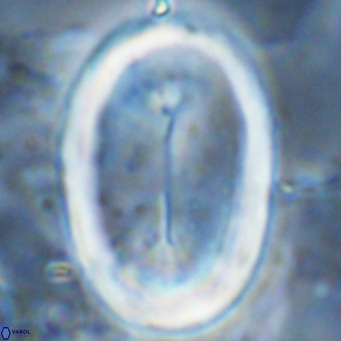 Pontosphaera sparsiforata VR 07538