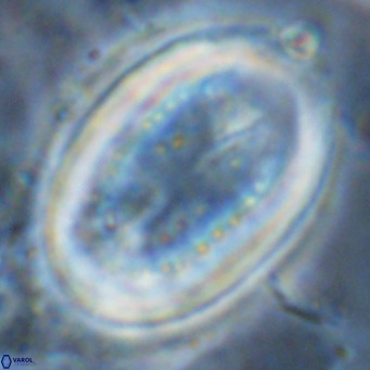 Pontosphaera sparsiforata VR 07539