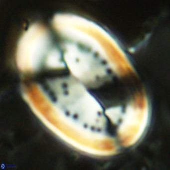 Pontosphaera sparsiforata VR 07530