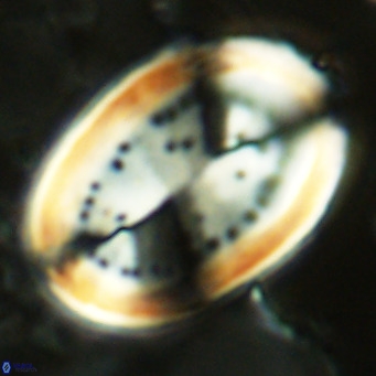 Pontosphaera sparsiforata VR 07531