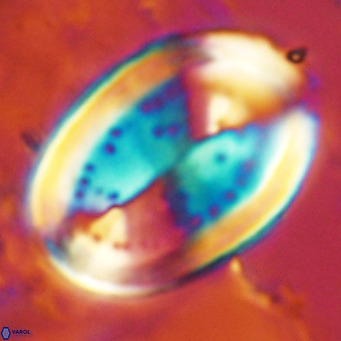 Pontosphaera sparsiforata VR 07532