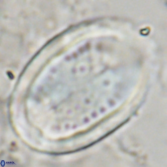 Pontosphaera sparsiforata VR 07533