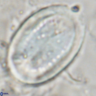 Pontosphaera sparsiforata VR 07540
