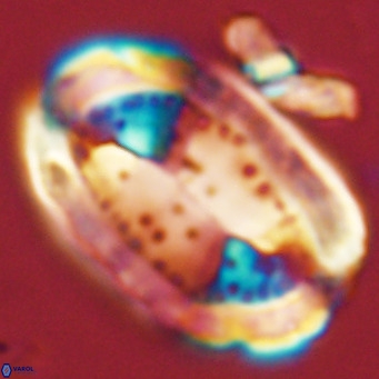 Pontosphaera sparsiforata VR 07715