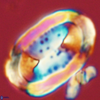 Pontosphaera sparsiforata VR 07716