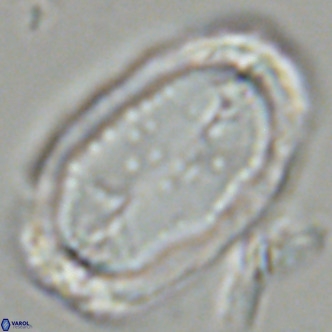 Pontosphaera sparsiforata VR 07718