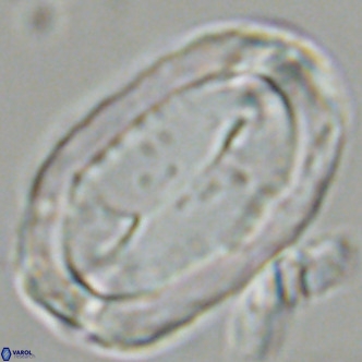 Pontosphaera sparsiforata VR 07719