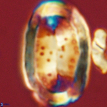 Pontosphaera sparsiforata VR 07710