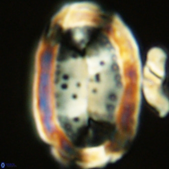 Pontosphaera sparsiforata VR 07711