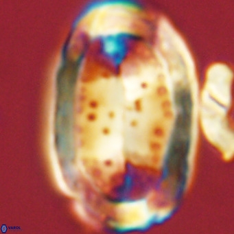 Pontosphaera sparsiforata VR 07712