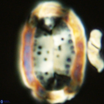 Pontosphaera sparsiforata VR 07713