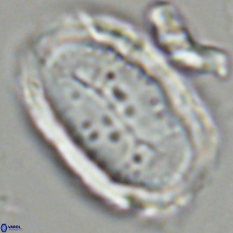 Pontosphaera sparsiforata VR 07724
