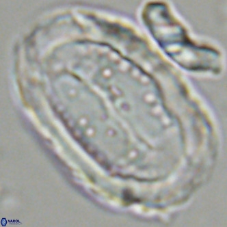 Pontosphaera sparsiforata VR 07725