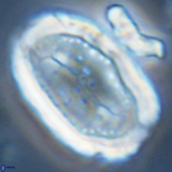 Pontosphaera sparsiforata VR 07726