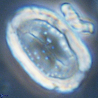 Pontosphaera sparsiforata VR 07727