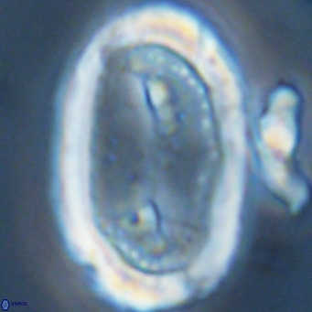 Pontosphaera sparsiforata VR 07728