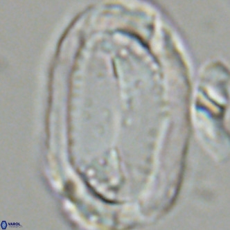 Pontosphaera sparsiforata VR 07720