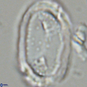 Pontosphaera sparsiforata VR 07721