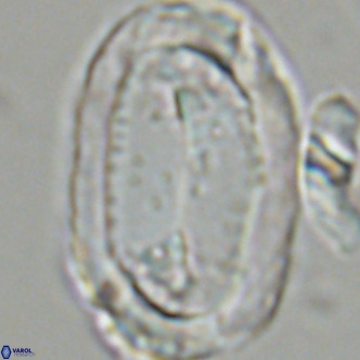Pontosphaera sparsiforata VR 07722