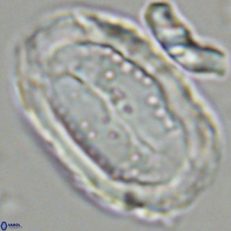 Pontosphaera sparsiforata VR 07723