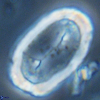 Pontosphaera sparsiforata VR 07730