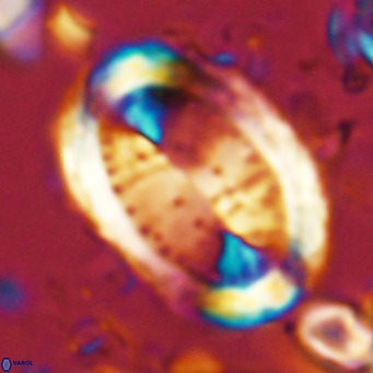 Pontosphaera sparsiforata VR 07854