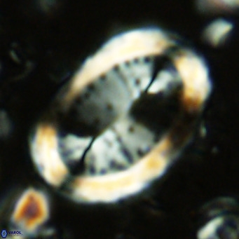 Pontosphaera sparsiforata VR 07857