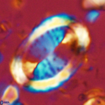 Pontosphaera sparsiforata VR 07858