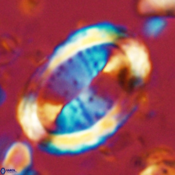Pontosphaera sparsiforata VR 07859
