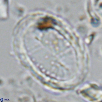 Pontosphaera sparsiforata VR 07864
