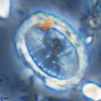Pontosphaera sparsiforata VR 07865