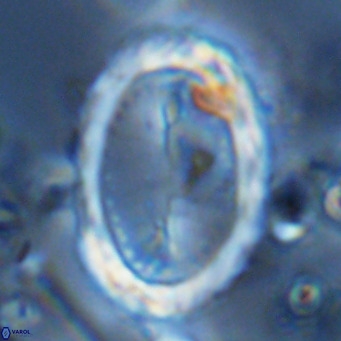 Pontosphaera sparsiforata VR 07866