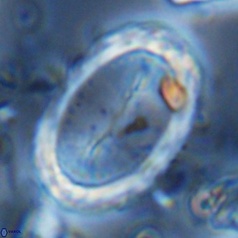 Pontosphaera sparsiforata VR 07867