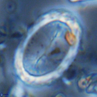 Pontosphaera sparsiforata VR 07868