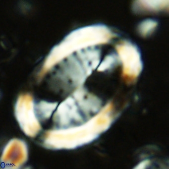 Pontosphaera sparsiforata VR 07860