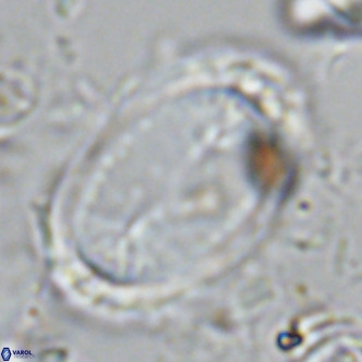 Pontosphaera sparsiforata VR 07861