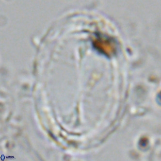 Pontosphaera sparsiforata VR 07863