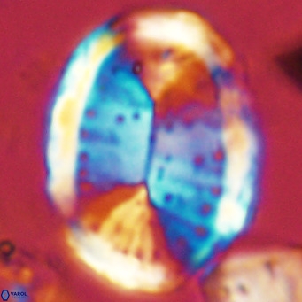 Pontosphaera sparsiforata VR 08335