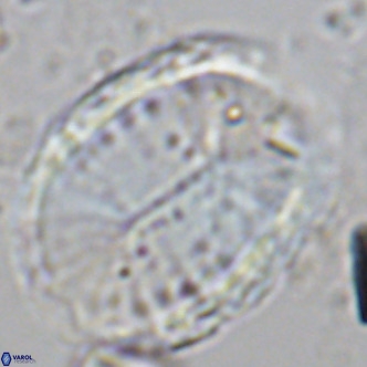 Pontosphaera sparsiforata VR 08345