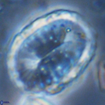 Pontosphaera sparsiforata VR 08347