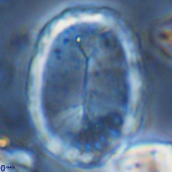 Pontosphaera sparsiforata VR 08349
