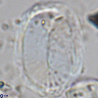 Pontosphaera sparsiforata VR 08342