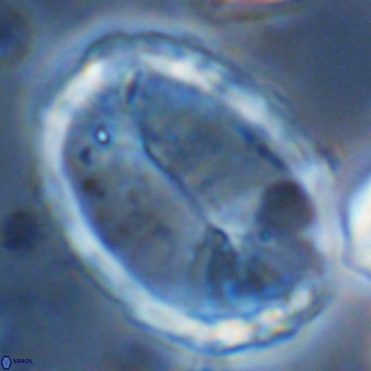 Pontosphaera sparsiforata VR 08350