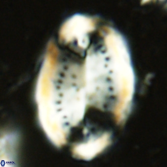 Pontosphaera sparsiforata VR 6892