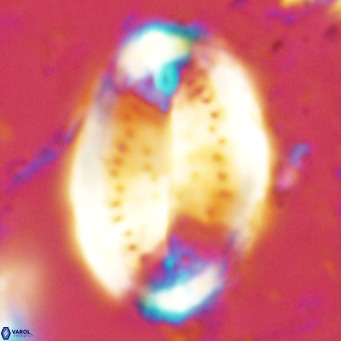 Pontosphaera sparsiforata VR 6895